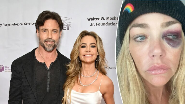 Denise Richards' estranged husband fires back at violent abuse allegations