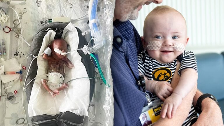 World's most premature baby defies all medical odds to reach 1st birthday