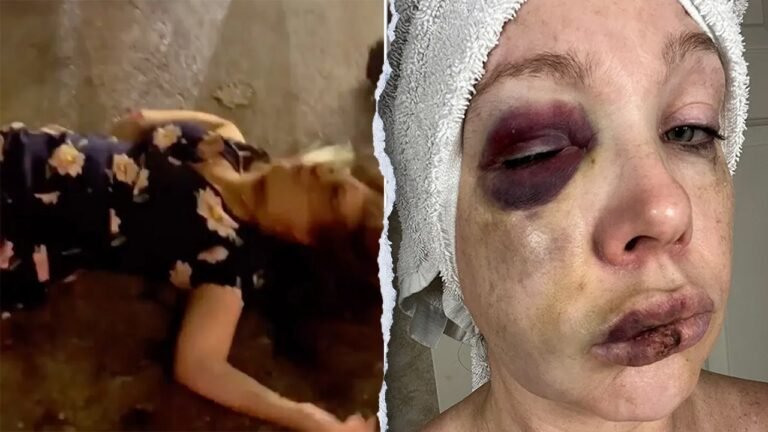 Cincinnati viral beating victim forced into 'super-secret spot' with security