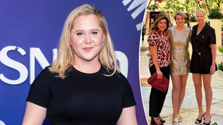 Amy Schumer displays 'legs for days' as comedian continues her weight-loss journey