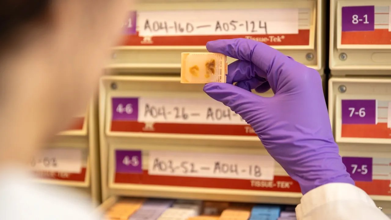 Fetal tissue supplier billed $765 procurement fee per organ, warn paperwork could imply illegal sales: records